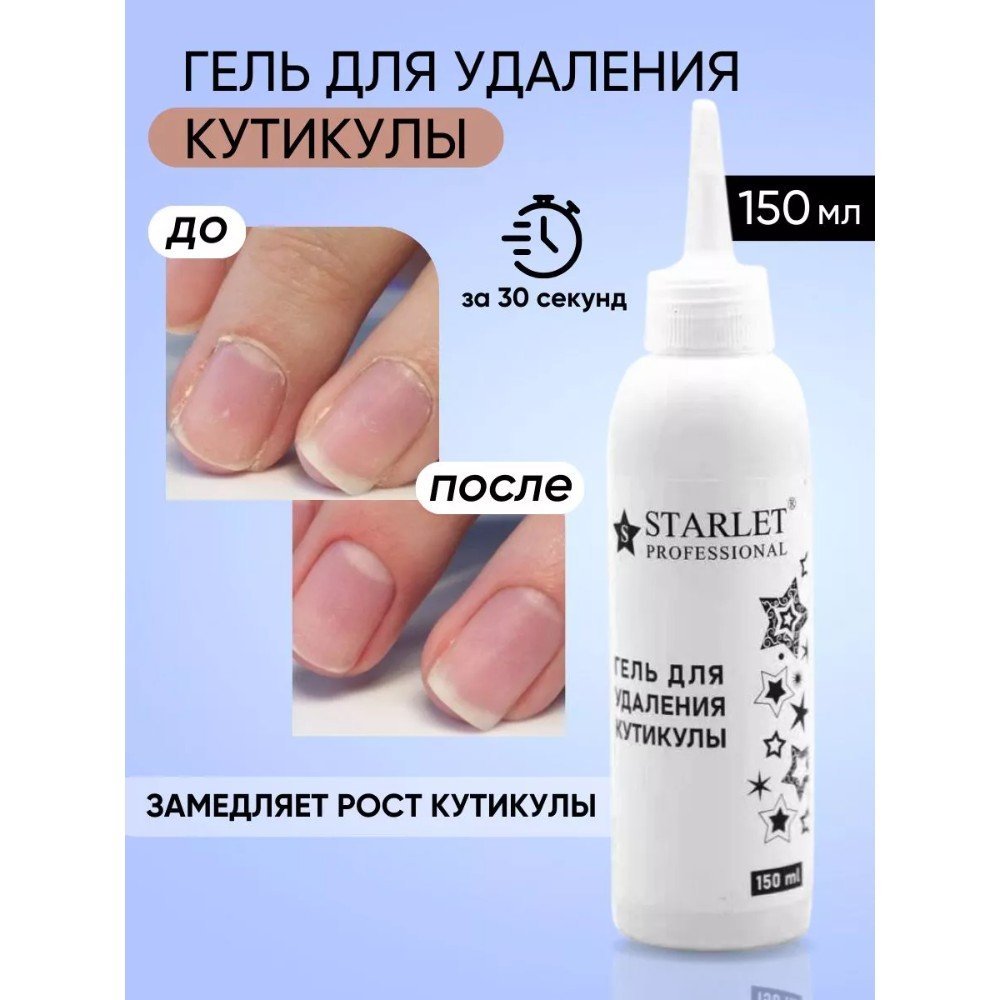 რემოვერი STARLET